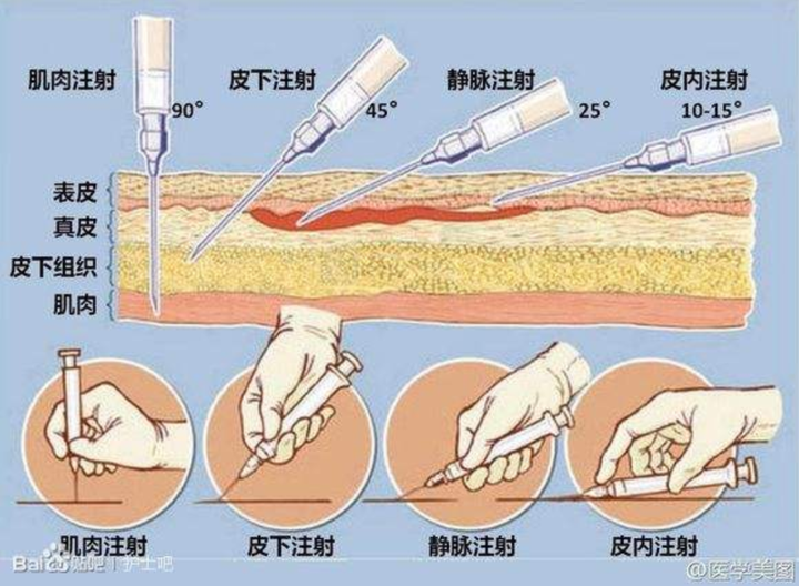 為什麼現在打針較少屁股了?