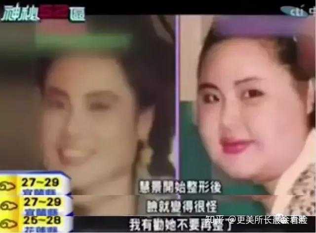 整容失败是种怎样的体验 知乎 整容失败是种怎样的体验 知乎