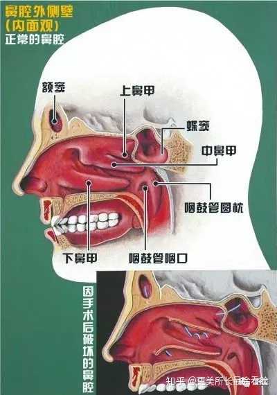 上中下鼻甲解剖图图片