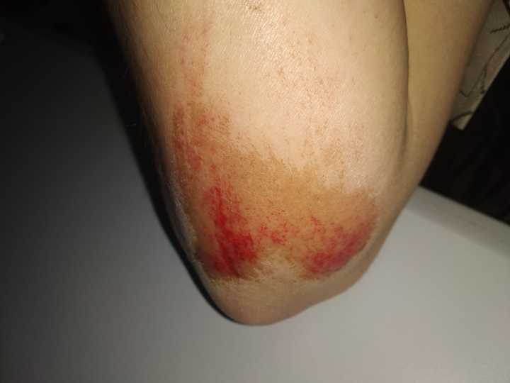 玩滑板摔倒是一种怎样的体验