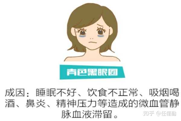 先来了解一下黑眼圈的类型和成因吧,顺便也说说改善的方法.