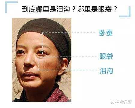 什么是 卧蚕 它跟眼袋有什么区别 知乎