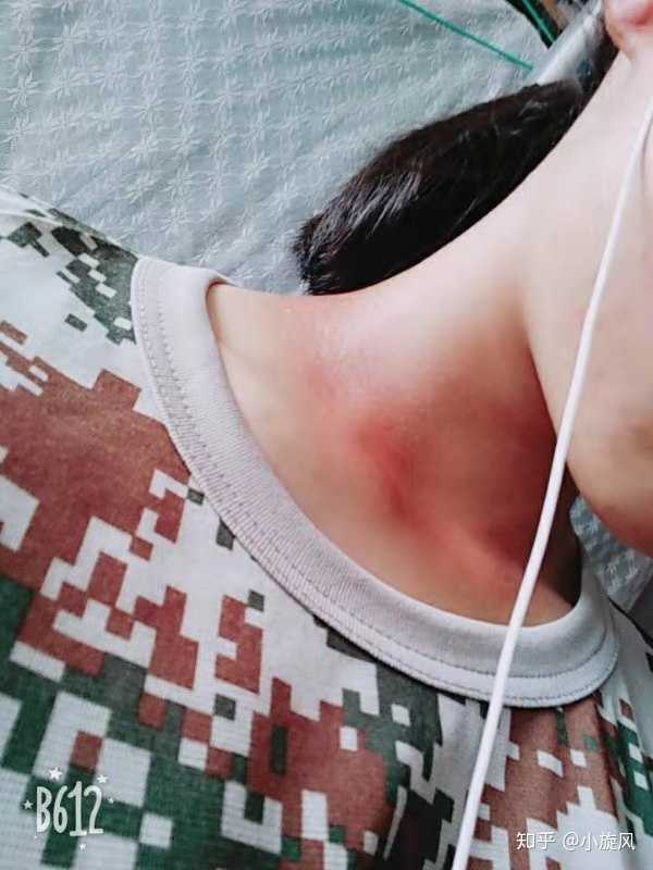 男生军训要用防晒吗?