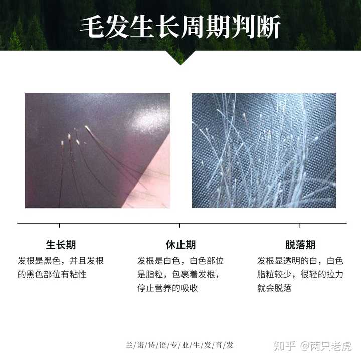 为什么掉落的头发的发根是这样子的?