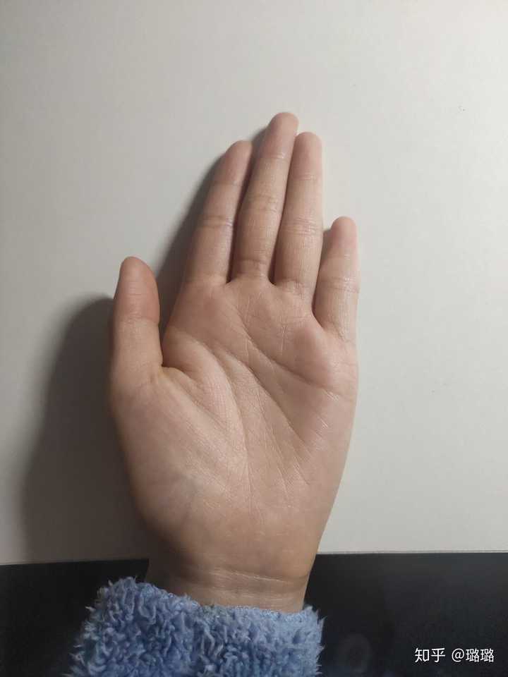 世界上手指最短的人图片
