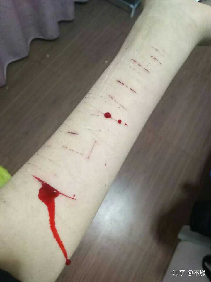 你被抑郁症折磨成什么样子了?