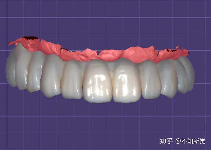 还是说这个东西在哪学都一样,车好牙形态,和对颌一样就行显示全部