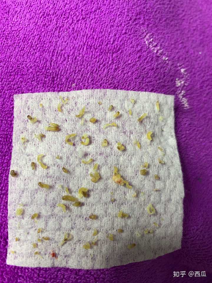 黑头大到直接挤出来是什么感受?