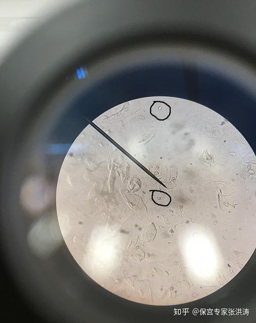 猫滴虫显微镜图片