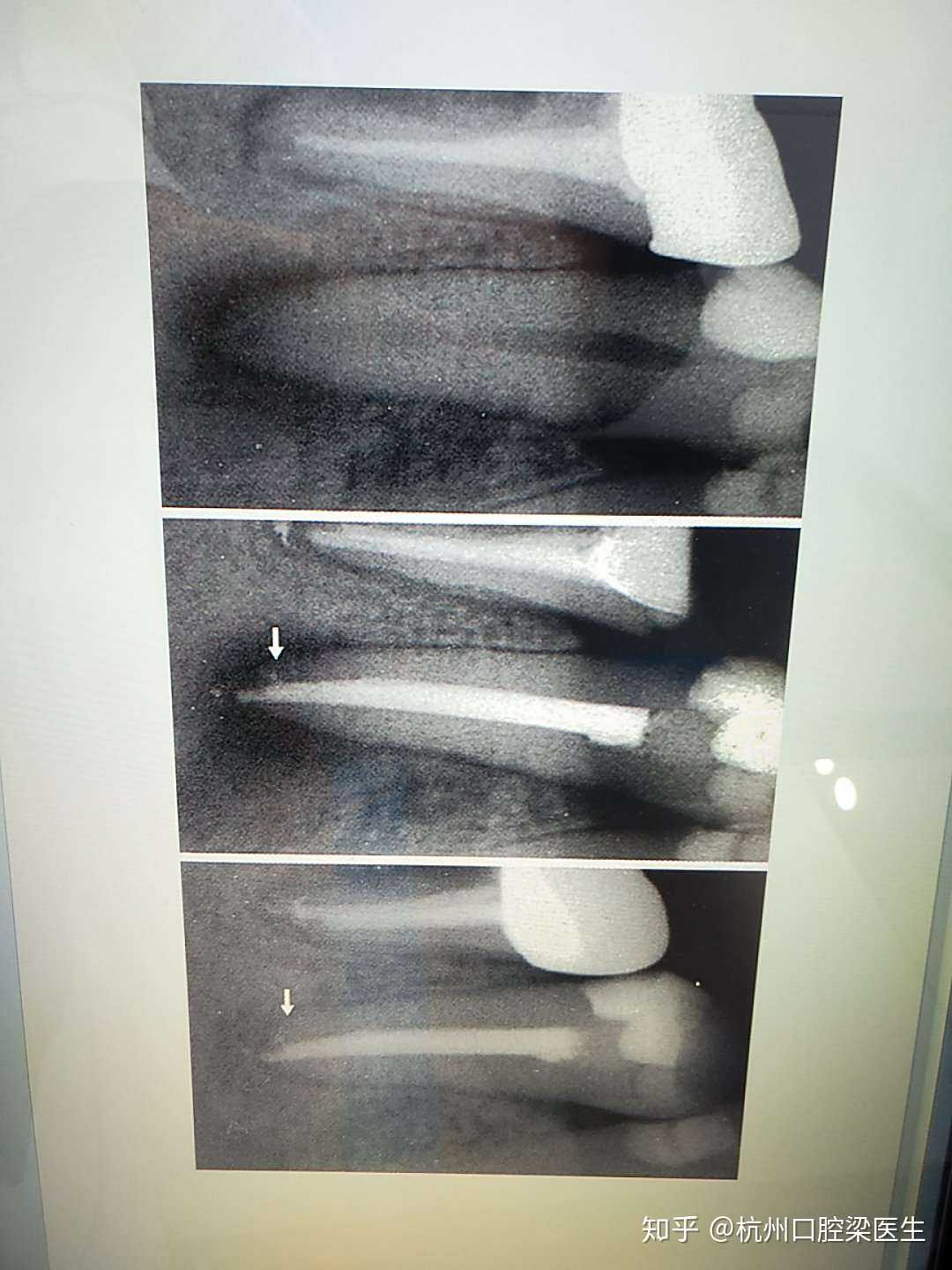 登录 杭州口腔梁医生 3 分享 举报 还没有评论 取消 评论 {"debug"