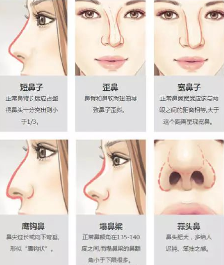 在你们眼中低鼻梁就没有好看的吗?