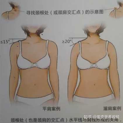 女生肩膀的上斜方肌太粗壮了怎么办 知乎 女生肩膀的上斜方肌太粗壮了怎么办 知乎