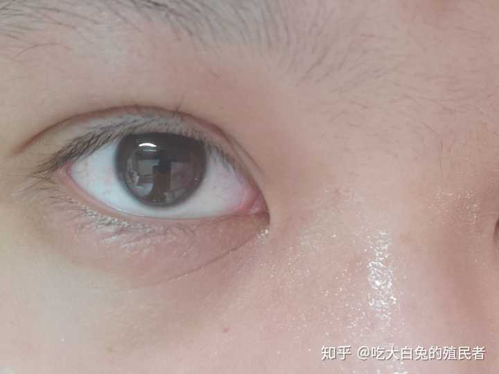 然后不负众望地过敏了,敷了硼酸后更严重了,于是左眼眼霜停了一个多月