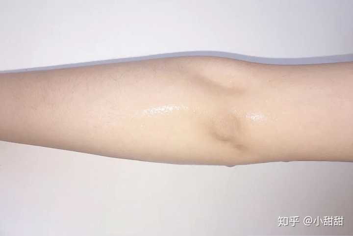 胳膊肘黑 洗澡搓不掉怎么办 知乎 胳膊肘黑 洗澡搓不掉怎么办 知乎
