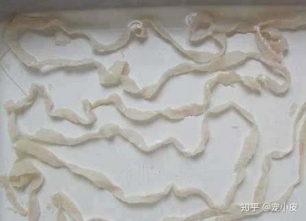 预防:定期为狗狗驱虫,不过通常人类感染钩虫不会有特别严重的症状,且