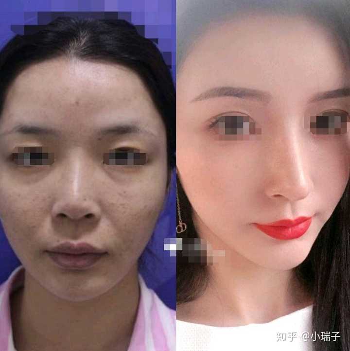 为什么整容一眼就能看出来 知乎