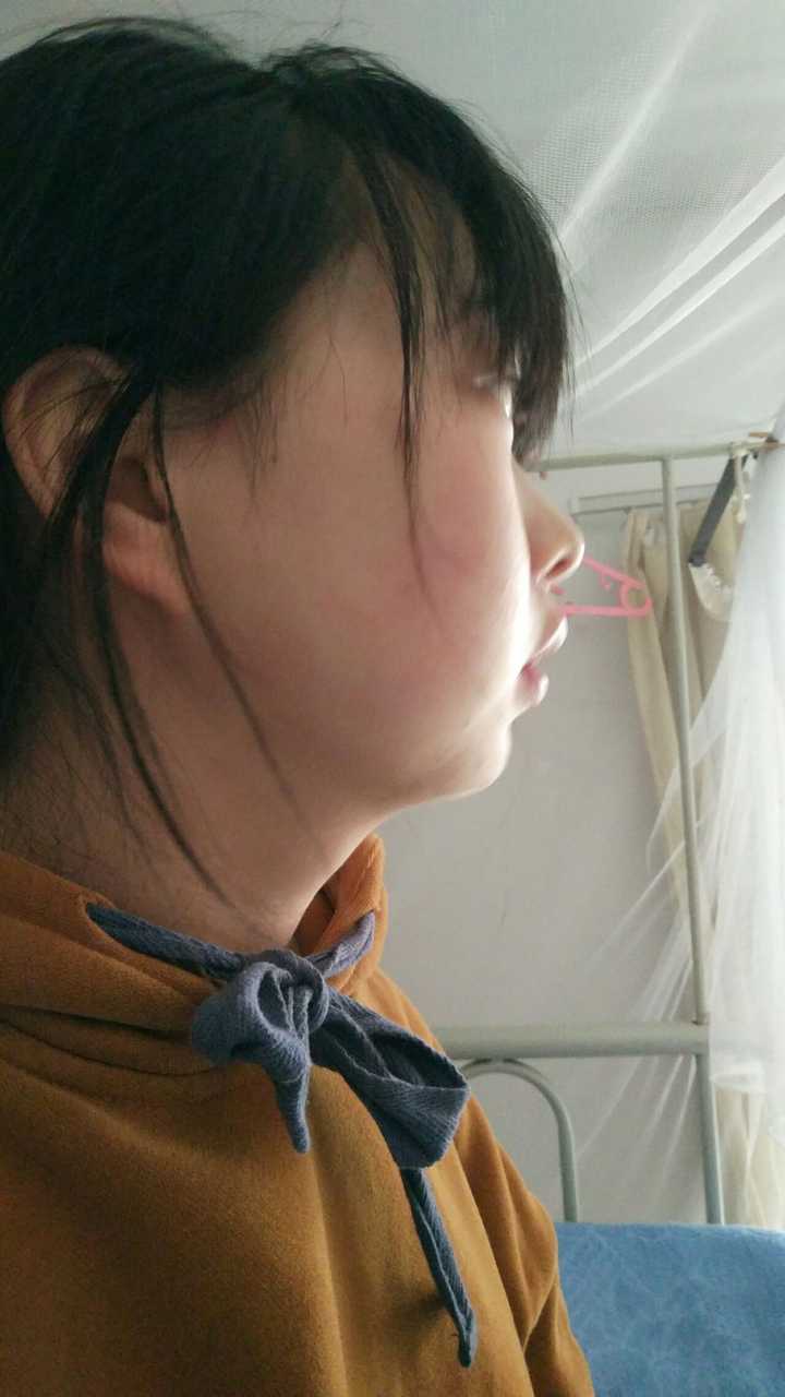 脸鼓没下巴的姑娘怎么变美?是不是没救了…?