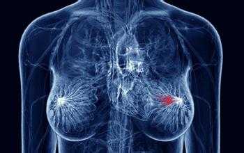 乳腺癌分期