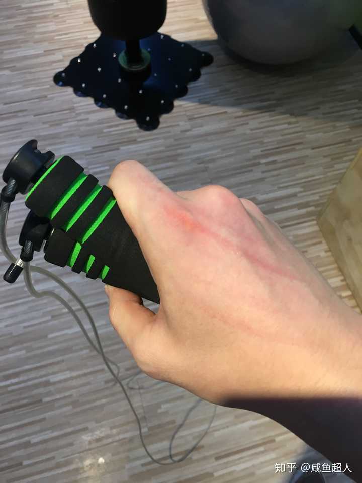 跳绳时抽到手右臂可能出现由内向外的伤痕吗?