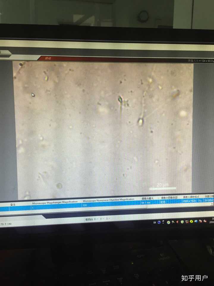 精子可以用普通的光学显微镜观察到么?