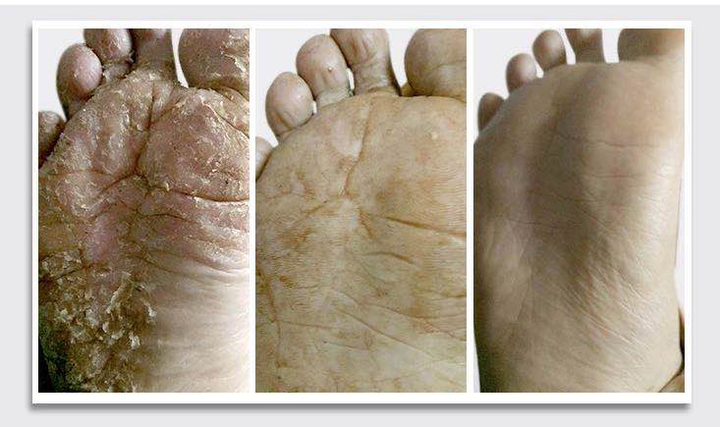 女生的脚都不臭吗?为什么?