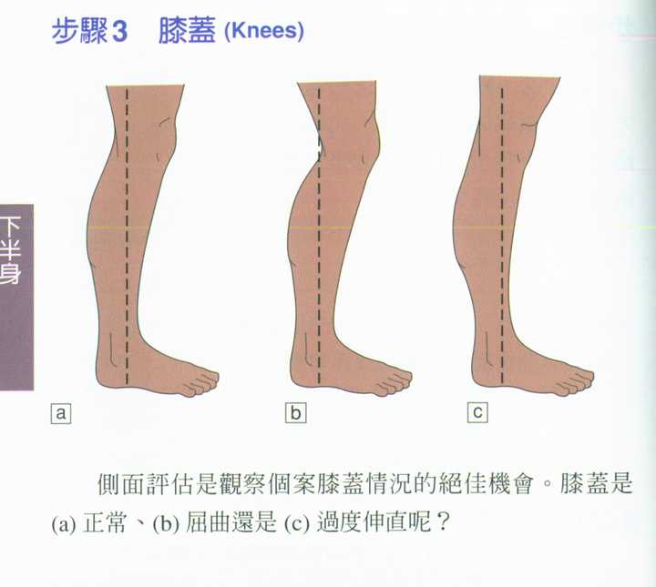 是什么导致膝超伸?