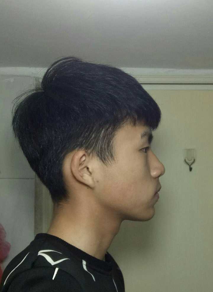 正颜好看侧颜丑是一种怎样的体验?