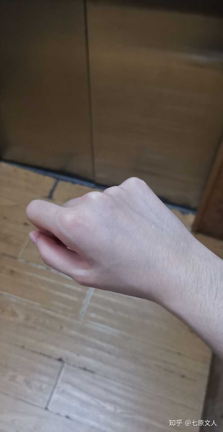 强迫性皮肤剥离症是什么 七原文人的回答 知乎 强迫性皮肤剥离症是什么 七原文人的回答 知乎