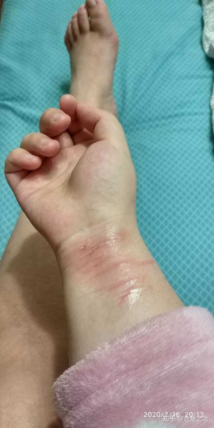 直面抑郁症需要多大的勇气?