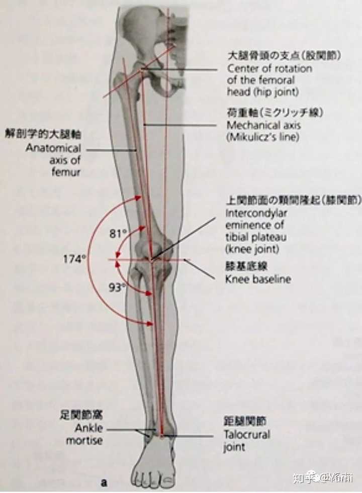 腿不直是什么原因 传说中的xo型 有什么补救措施吗 已上图 知乎