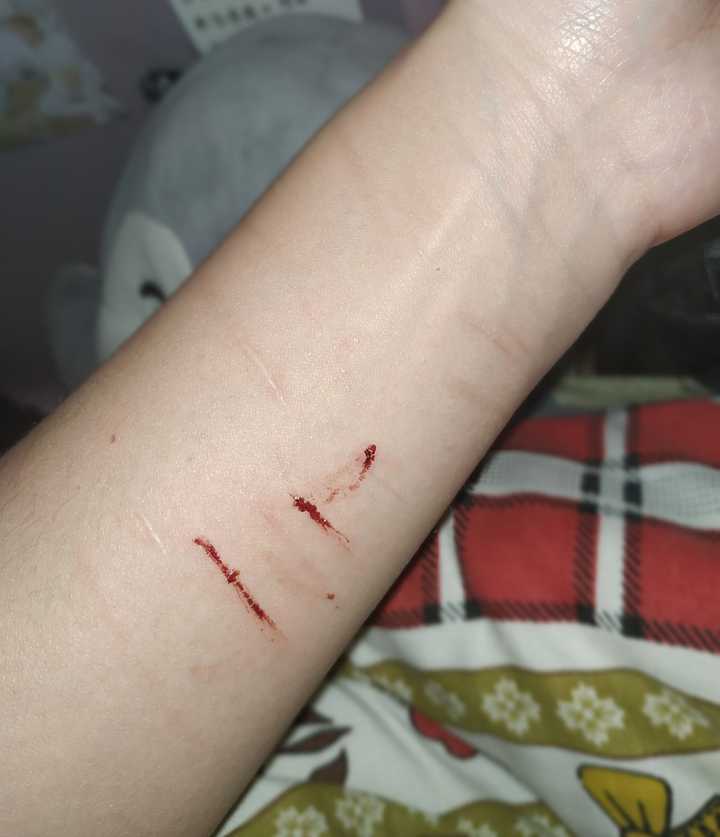 抑郁症患者眼中世界是什么样的?