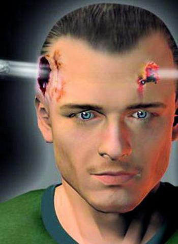 影视剧中头部中枪(非爆裂)后一两秒内倒下的情景是否属实?