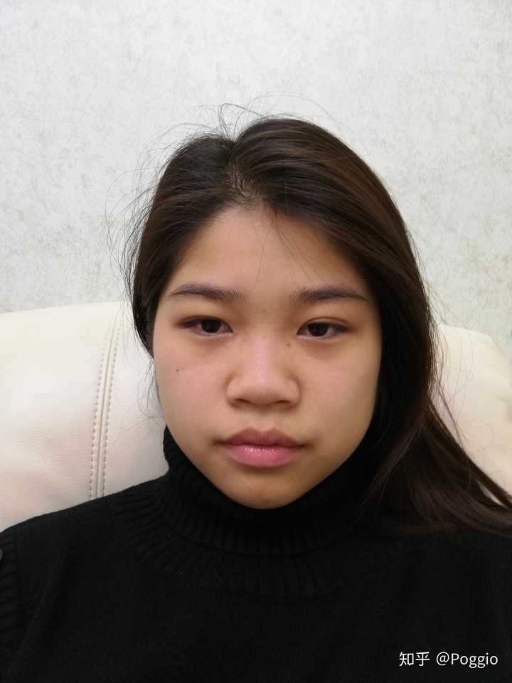 为什么鼻子丑的人无法好看