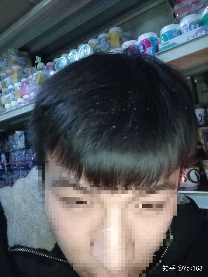男生头发少,稀疏,细软适合留什么发型?