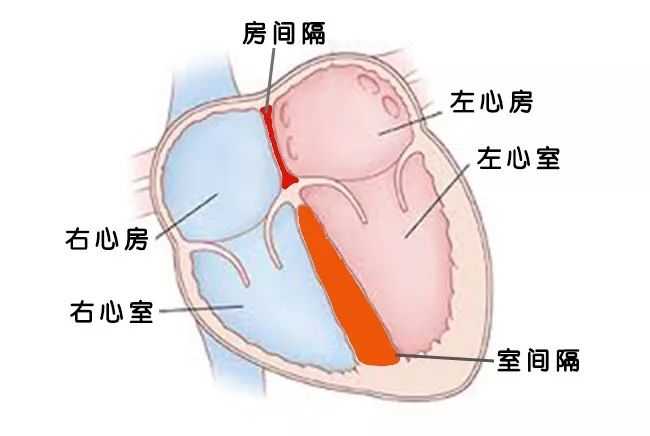 先心病房间隔缺损多大必须手术 知乎 先心病房间隔缺损多大必须手术 知乎
