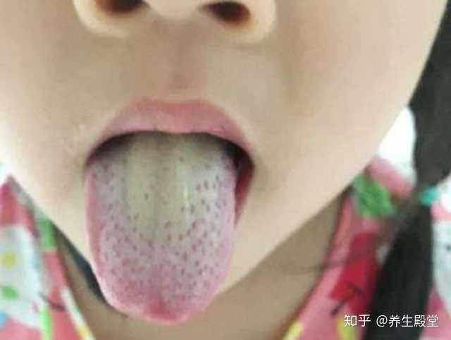 长期肠胃不好 伴有口臭 舌苔厚白 该如何调养 知乎 长期肠胃不好 伴有口臭 舌苔厚白 该如何调养 知乎