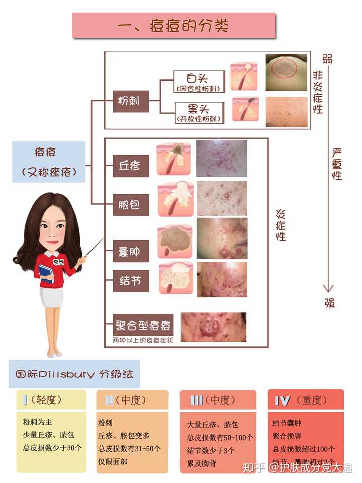 可以参考常见的痘痘分级