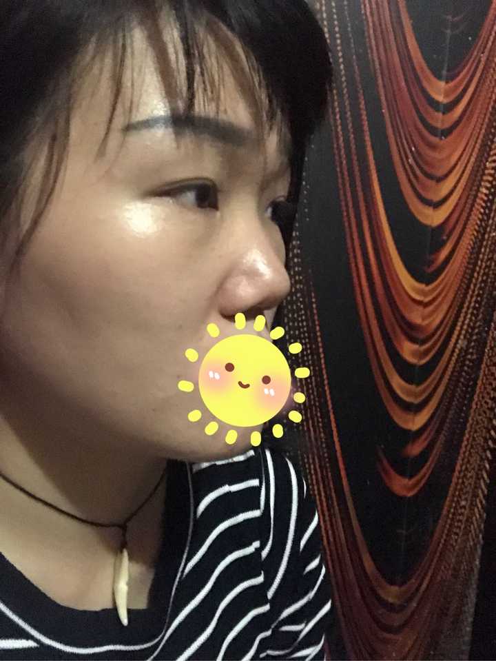 评论那些,根本不算塌鼻梁好吧…只是山根不够高而已.我这种才是.(哭)