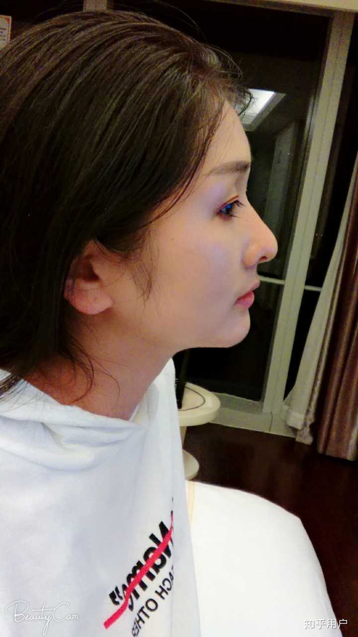 鼻子太挺拔有什么体验?