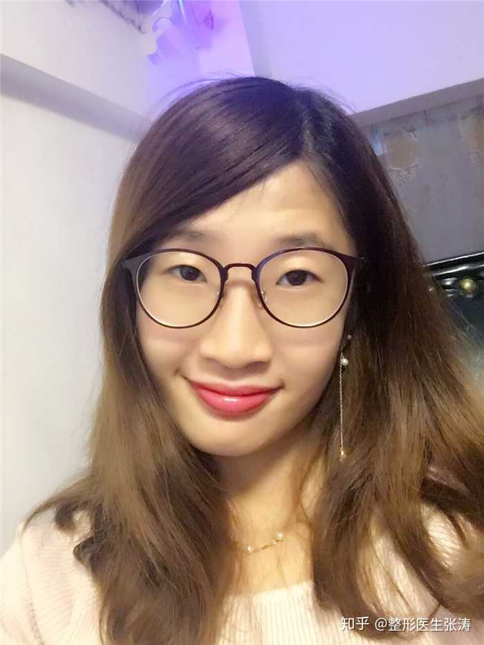 有人和我一样大小眼这么严重吗?