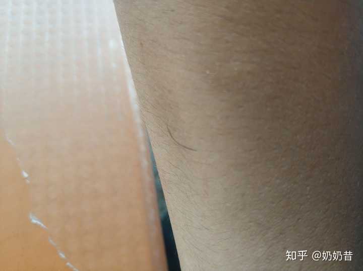 胳膊上长了根特别硬的汗毛,揪了过了几天在原地方又长一根,这次没揪