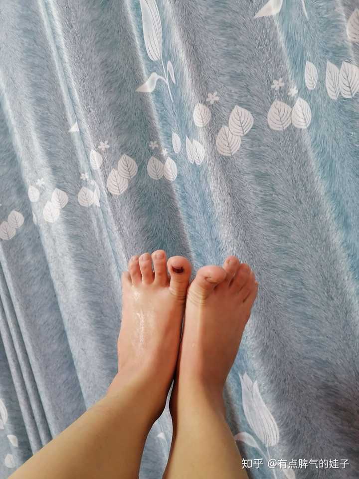 昨天晚上泡完脚的红蹄子,睡着浑身都不困了