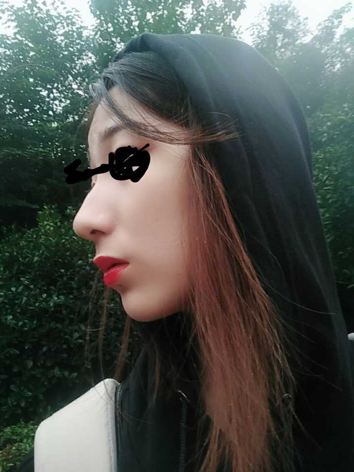 鼻子太挺拔有什么体验?