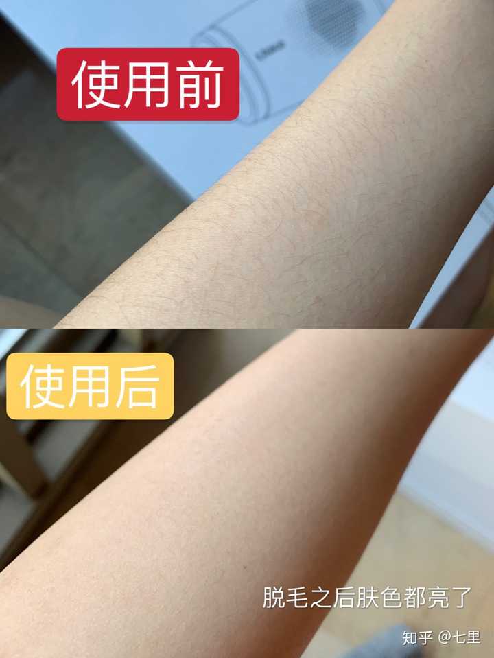 如何科学安全地脱毛 知乎 如何科学安全地脱毛 知乎