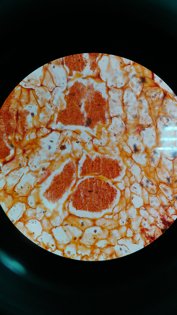 透过显微镜拍的最好的一次了,白菜根肿病的病原菌.