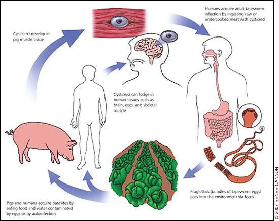 即从虫卵到发育为成虫,感染我们人类的整个过程我们人类是猪肉绦虫的