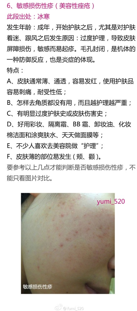 满脸痘痘很自卑,怎么办? - 青春痘 - 知乎