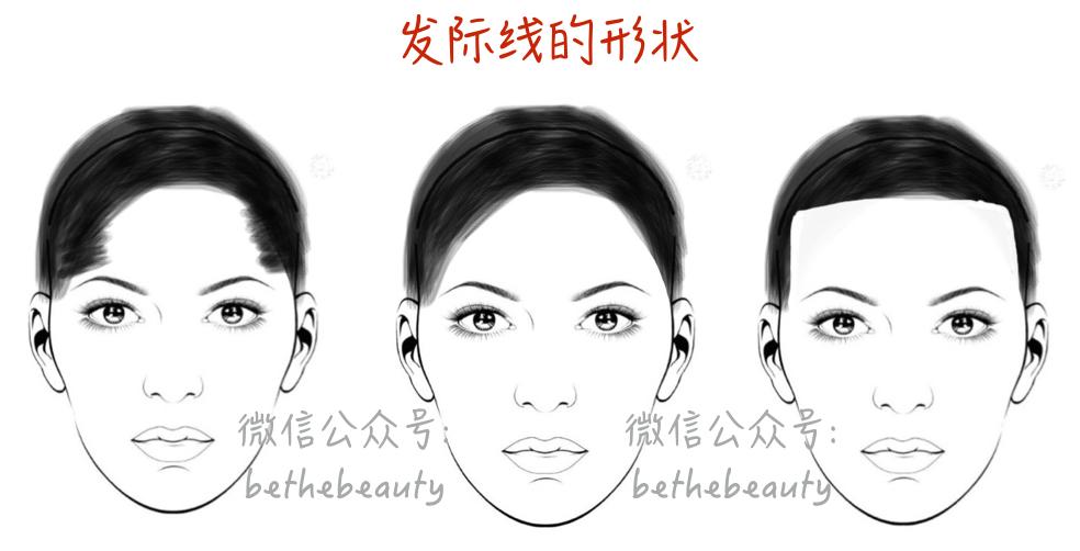 90%的发际线问题都不用去整形的——看本文就好了! - 知乎