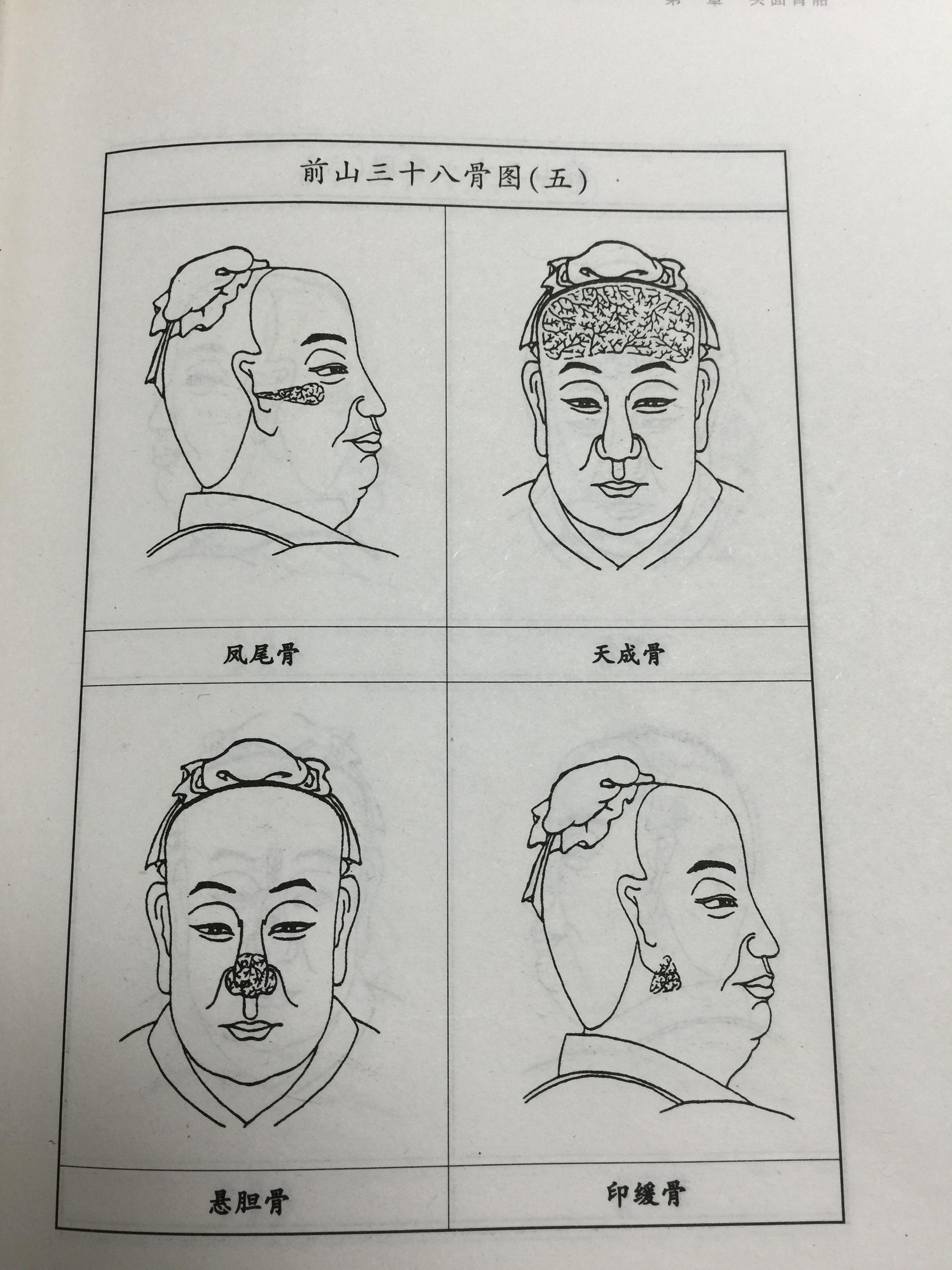 哪位大神知道枕骨天庭骨太阳骨在哪最好有图片求指教