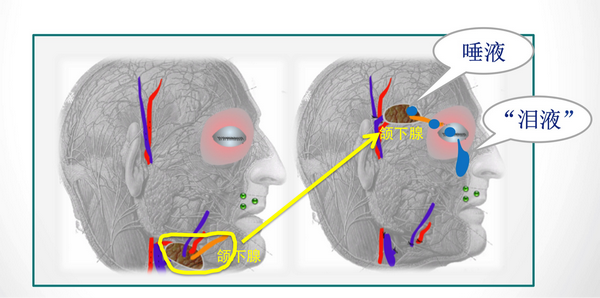 所以就有一种方法,把人体负责分泌口水的器官之一,颌下腺,从颈部完整